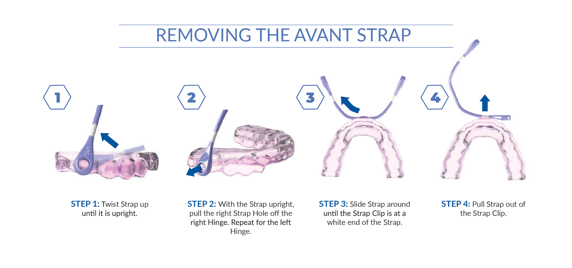 removing-the-avant-strap